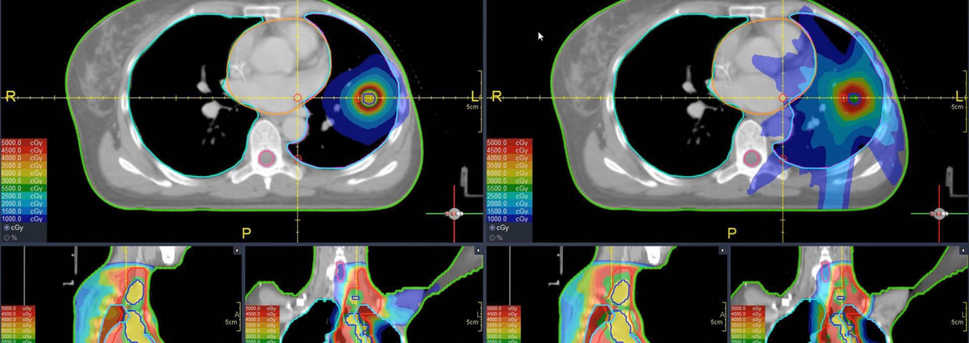 Case 1 treatment planning images — image 1 of 3